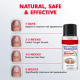 Maxbell Gentle Nail Fungus Treatment for Discolored Toenails Hard Cracked Nails