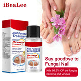 Maxbell Gentle Nail Fungus Treatment for Discolored Toenails Hard Cracked Nails