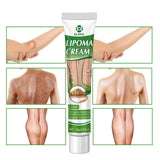 Maxbell 0.71fl.oz Lipoma Removal Cream Portable Easy to Use for Whole Body Ointment