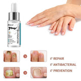 Maxbell 20ml Nail Repair essence Liquid for Thick Brittle Damaged Discolored Nails