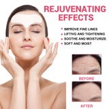 Maxbell Forehead Wrinkle Patches Bag of 5Pcs Smooth Wrinkle Anti Wrinkle Pads Soft