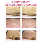 Maxbell Forehead Wrinkle Patches Bag of 5Pcs Smooth Wrinkle Anti Wrinkle Pads Soft