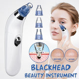 Maxbell Electric Blackhead Remover Pore Vacuum Suction Face Cleaner for Men Women