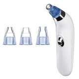 Maxbell Electric Blackhead Remover Pore Vacuum Suction Face Cleaner for Men Women