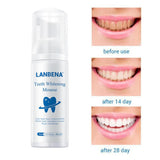 Daily Teeth Whitening Whiten Foam for Home Use Maintain a Brighter Smile