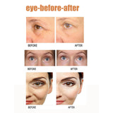 Rapid Reduction Eye Cream Under-Eye Bag Treatment Instant Results Fine Lines