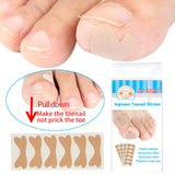 Glue Free Ingrown Toenail Stickers Corrector for Women Nail Treatment Tools 36 pcs