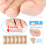 Glue Free Ingrown Toenail Stickers Corrector for Women Nail Treatment Tools 48 pcs