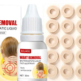 Maxbell Wart Remover 30ml Wart Removal Common Warts
