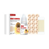 Maxbell Wart Remover 30ml Wart Removal Common Warts