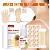 Maxbell Wart Remover 30ml Wart Removal Common Warts