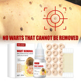 Maxbell Wart Remover 30ml Wart Removal Common Warts