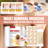 Maxbell Wart Remover 30ml Wart Removal Common Warts