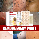 Maxbell Wart Remover 30ml Wart Removal Common Warts