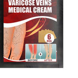 Maxbell 6pcs Vein massage varicose leg vein patch with optional pen without pen