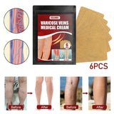 Maxbell 6pcs Vein massage varicose leg vein patch with optional pen without pen
