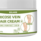 Maxbell Varicose Cream Soothing Improve Blood Circulation for Leg Men Women