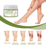 Maxbell Varicose Cream Soothing Improve Blood Circulation for Leg Men Women