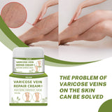 Maxbell Varicose Cream Soothing Improve Blood Circulation for Leg Men Women