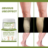 Maxbell Varicose Cream Soothing Improve Blood Circulation for Leg Men Women