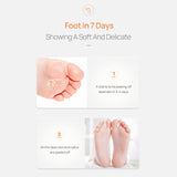 Maxbell Foot Peel Masks Peeling Remover Soothe Feet for Cracked Feet Treatment vitamin C