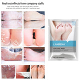 Maxbell Foot Peel Masks Peeling Remover Soothe Feet for Cracked Feet Treatment No fragrance