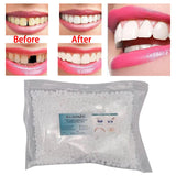 Maxbell Temporary Tooth Repair Kit Fix The Missing Tooth Teaching Easy to Use Safe