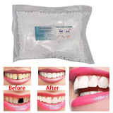 Maxbell Temporary Tooth Repair Kit Fix The Missing Tooth Teaching Easy to Use Safe