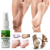 Maxbell Foot Itching Spray Sweaty Feet Antipruritic Toes Itching for Athlete Men