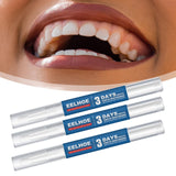 Maxbell Portable Travel Teeth cleaning pen Fast Whitening Teeth Bleaching 2Pcs