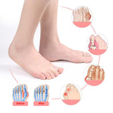 Maxbell 2 Pieces Toe Separators Toe Protection for Hallux Valgus Size S