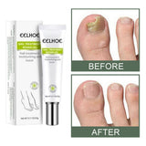 Maxbell Professional Nail Fungus Repair Gel Moisturizing 0.7 oz/20G for Toenail