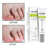 Maxbell Professional Nail Fungus Repair Gel Moisturizing 0.7 oz/20G for Toenail
