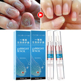 Maxbell Nail Fungal Treatment Pen 3ml Foot Toenail for Nail Roughness Nail Cracking