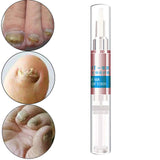 Maxbell Nail Fungal Treatment Pen 3ml Foot Toenail for Nail Roughness Nail Cracking