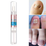 Maxbell Nail Fungal Treatment Pen 3ml Foot Toenail for Nail Roughness Nail Cracking