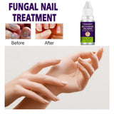Maxbell Feet Care Essence Moisturizing for Yellowing Discoloration Uneven Surface