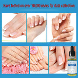 Maxbell nails repair Essence Liquid Nail Fungus Treatments for Toenail Fingernail