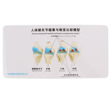 Human Pathological Knee Joint Health Lesion Comparison Skeleton Model Set Lab Equipment Educative - Aladdin Shoppers