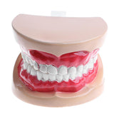 Maxbell 2X Large Children Dental Teeth Model Dentist Teaching Oral Hygiene Tool