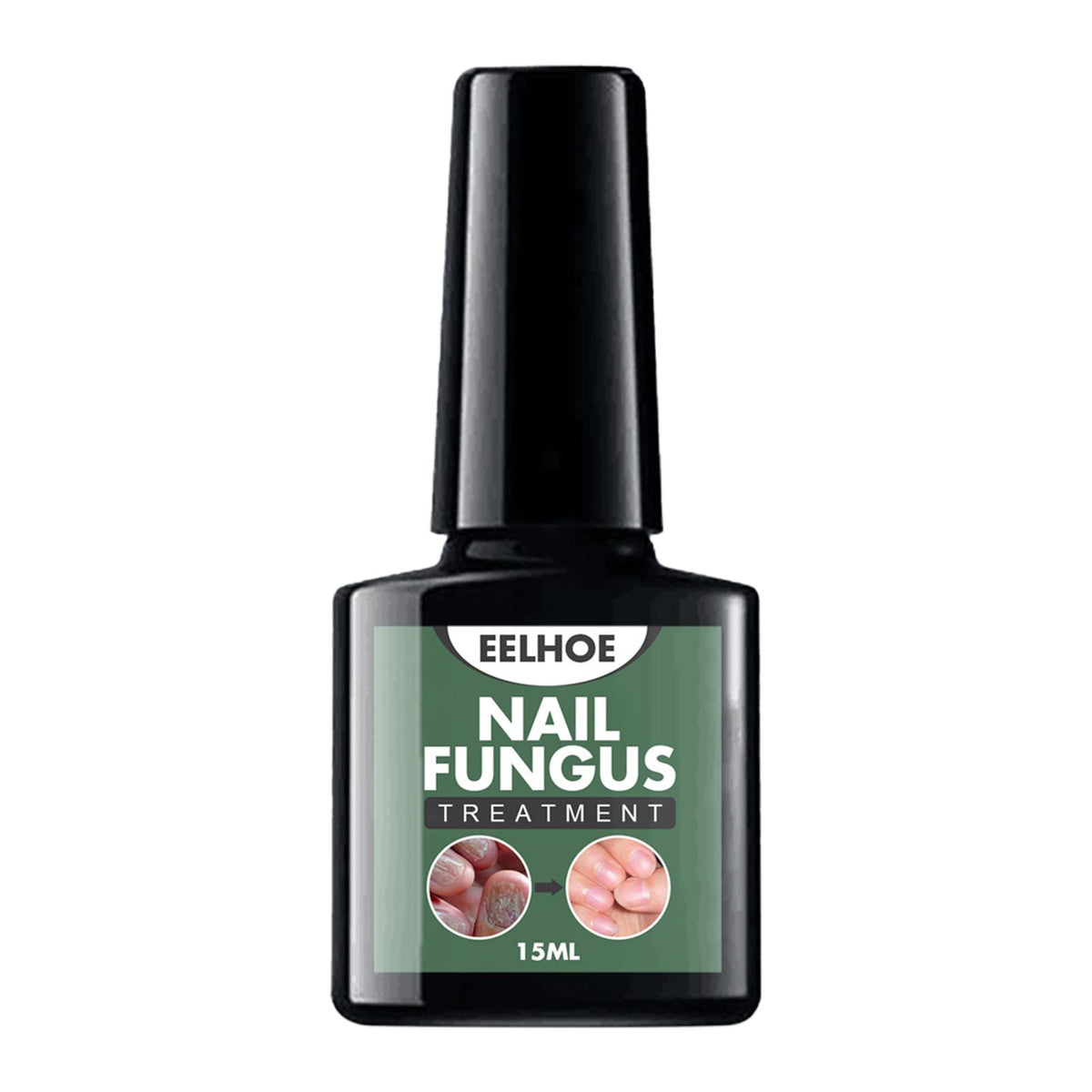 Maxbell Nail Fungal Treatment 15ml Nails Manicure for Nail Cracking Discoloration