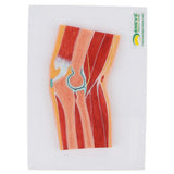 Maxbell 1:1 Advanced Human Elbow Joint Muscle Skeleton MRI Section Medical Model