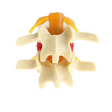Maxbell Professional Human Lumbar Intervertebral Disc Protrusion Lab Demonstration Display Model Magnification 2x - Aladdin Shoppers
